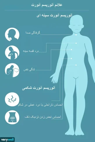 علائم آنوریسم آئورت