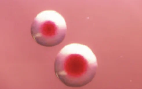 کلنی های چشم گاو مانند