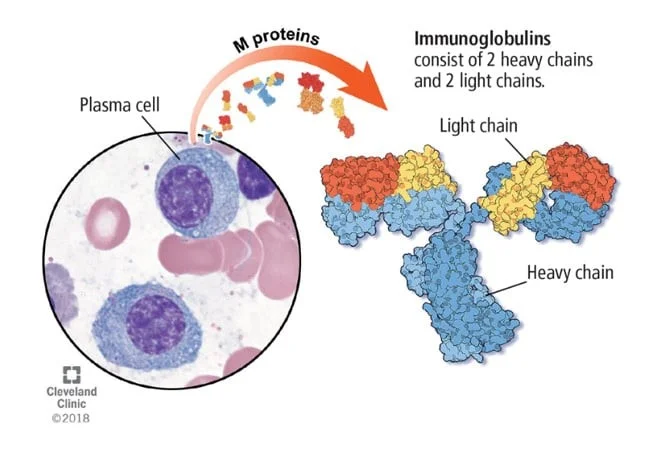 گاموپاتی مونوکلونال با اهمیت نامشخص
