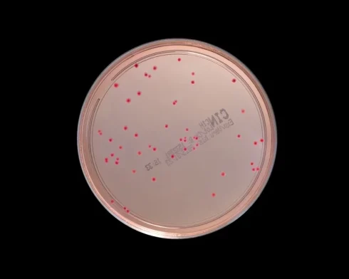 محیط کشت CIN چیست؟