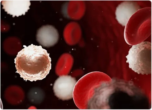 گرفتن سلول‌های لوسمی در گردش برای بررسی توسط فلوسایتومتری