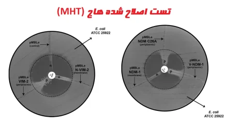 نتایج تست اصلاح شده هاج (تست MHT)