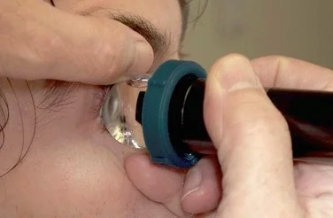 بیومیکروسکوپی اولتراسوند