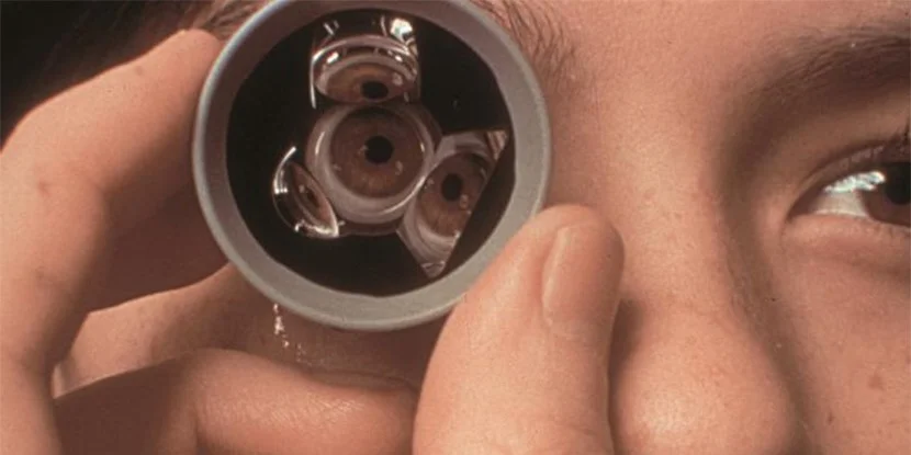 لنز گونیوسکوپی