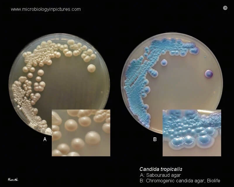Candida tropicalis روی Sabouraud agar و Chromogenic candida agar.
