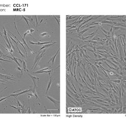 Alternative view of رده سلولی MRC-5
