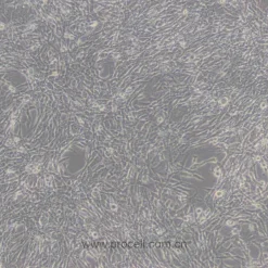 Alternative view of رده سلولی TM4