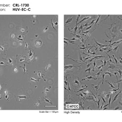Alternative view of رده سلولی HUVEC