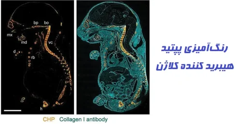 نتیجه و تفسیر رنگ آمیزی پپتید هیبرید کننده کلاژن
