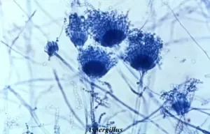 گونههای آسپرژیلوس (Aspergillus) در مانت LPCB