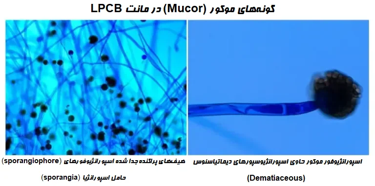 گونههای موکور در مانت LPCB