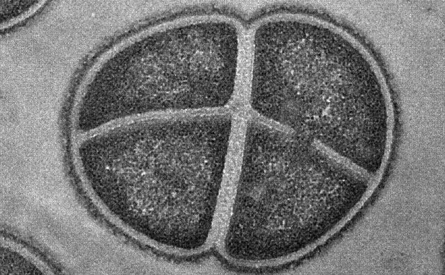 باکتری Bacillus stearothermophilus