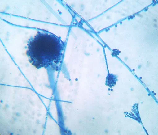 مانت های لاکتوفنول کاتن بلو