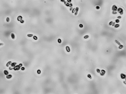 کاندیدا پاراپسیلوزیس چیست؟