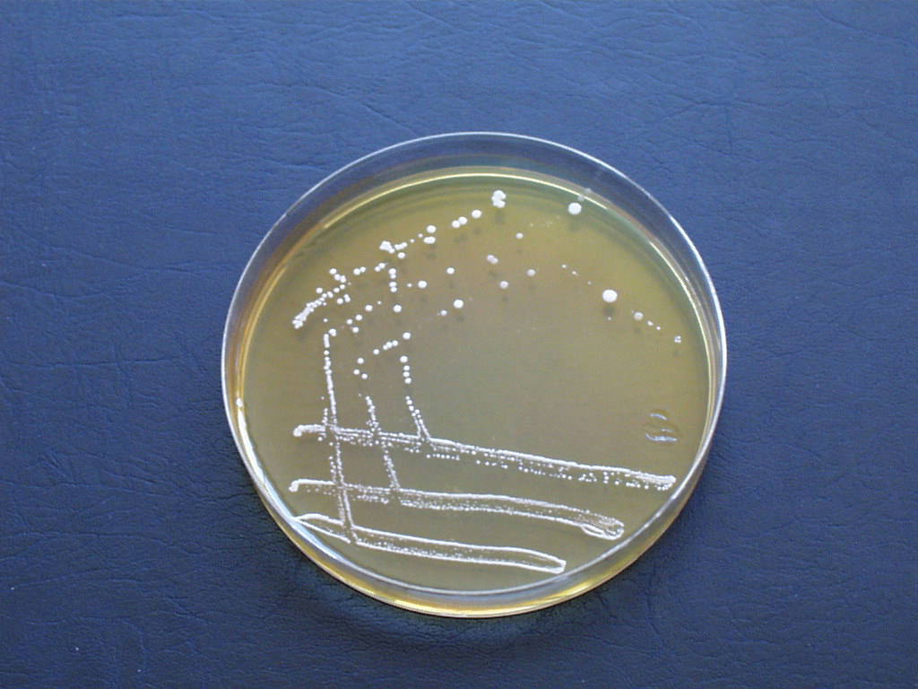 کلنی‌های L. acidophilus روی پلیت های نوترینت آگار