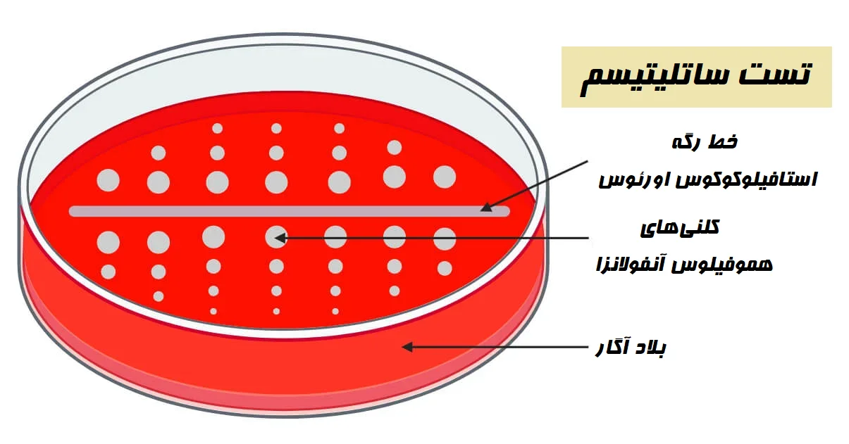 نتیجه و تفسیر تست ساتلیتیسم