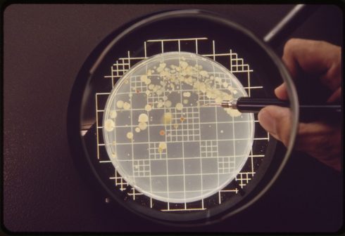 شمارش میکروسکوپی مستقیم