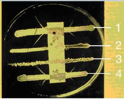 روش انجام تست الک