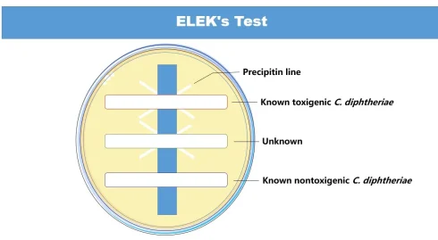 تست الک چیست؟