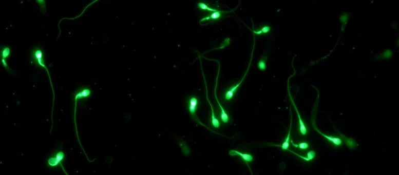نمونه اسپرماتوزوآ (Spermatozoa) انسان