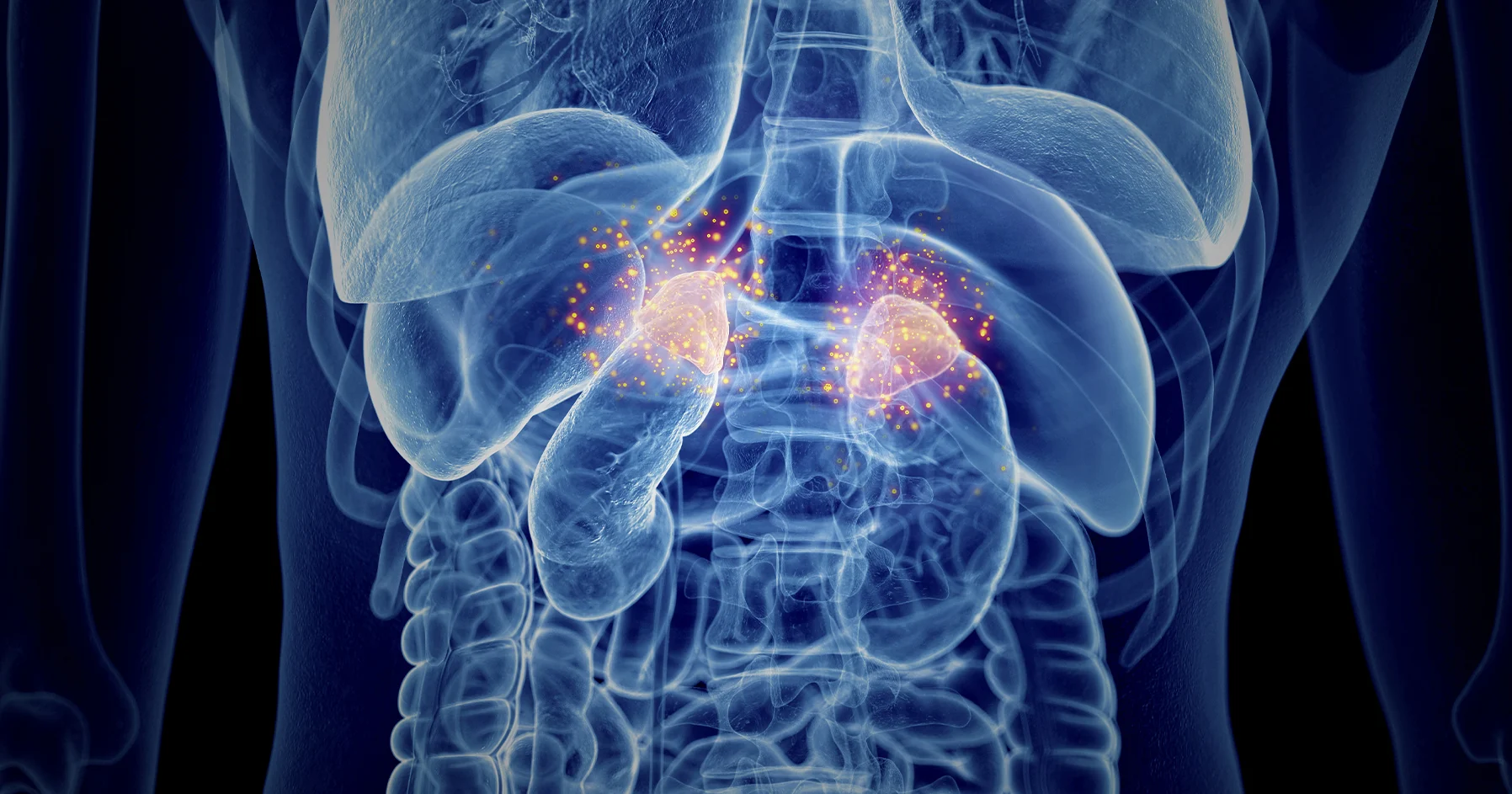 علل بیماری آدیسون