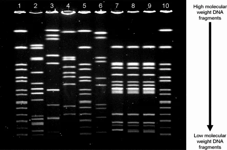پروفایل اثر انگشت DNA تولید شده توسط PFGE