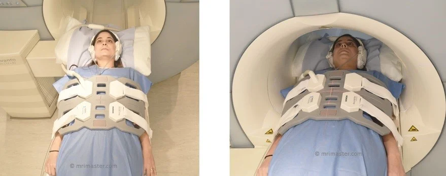 کلانژیوپانکراتوگرافی رزونانس مغناطیسی MRCP