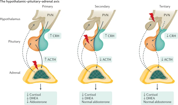 بیماری کمبود ACTH