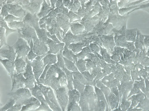خرید رده سلولی SK-OV-3