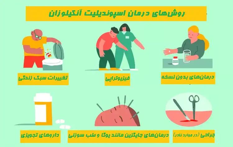 درمان اسپوندیلیت آنکیلوزان