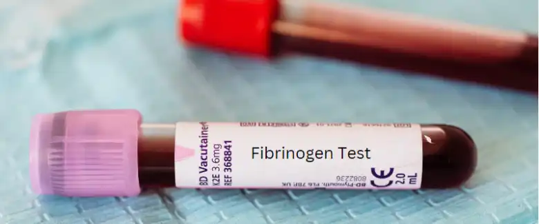 آزمایش فیبرینوژن