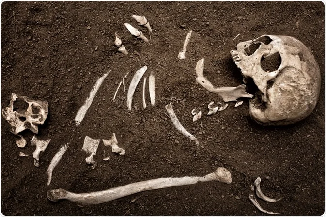 پزشکی قانونی و استخوان