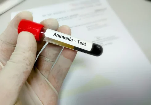 آزمایش آمونیاک خون چیست؟