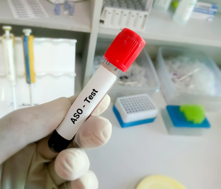 تیتر آنتی استرپتولیسین O چیست؟