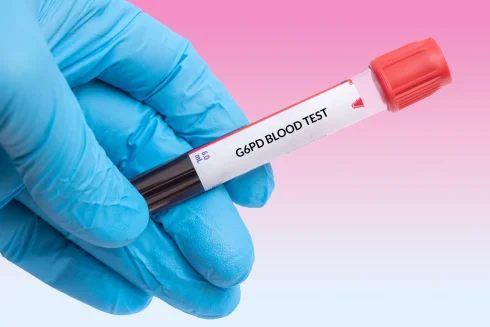 آزمایش G6PD چیست؟