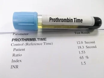 نتایج آزمایش PT