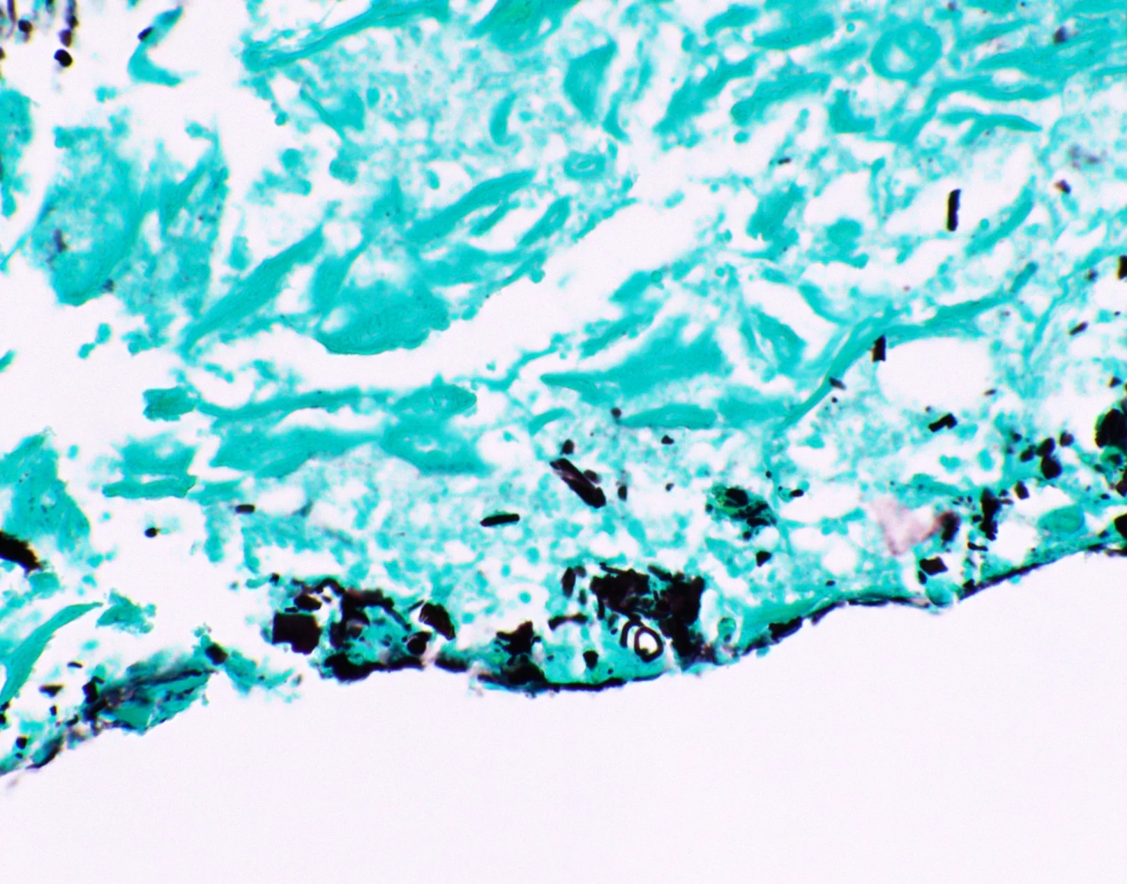 رنگ آمیزی گوموری متنامین سیلور