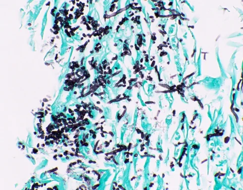 رنگ آمیزی GMS