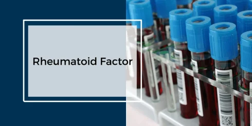 تست RF چیست؟