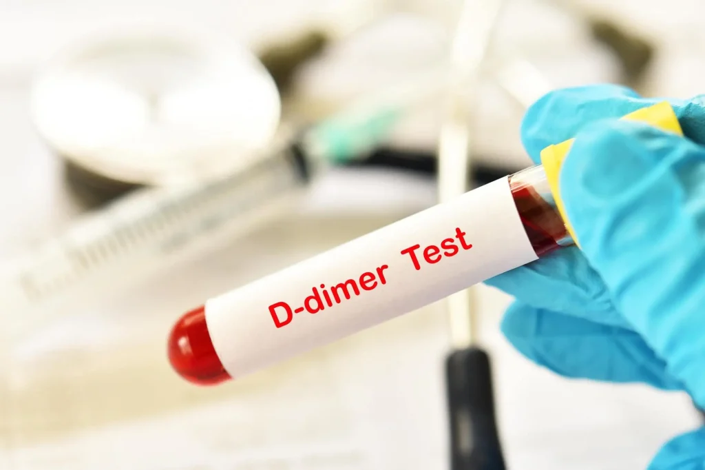آزمایش D-dimer