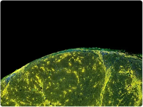 فلوروکروم در فلوسایتومتری چیست؟