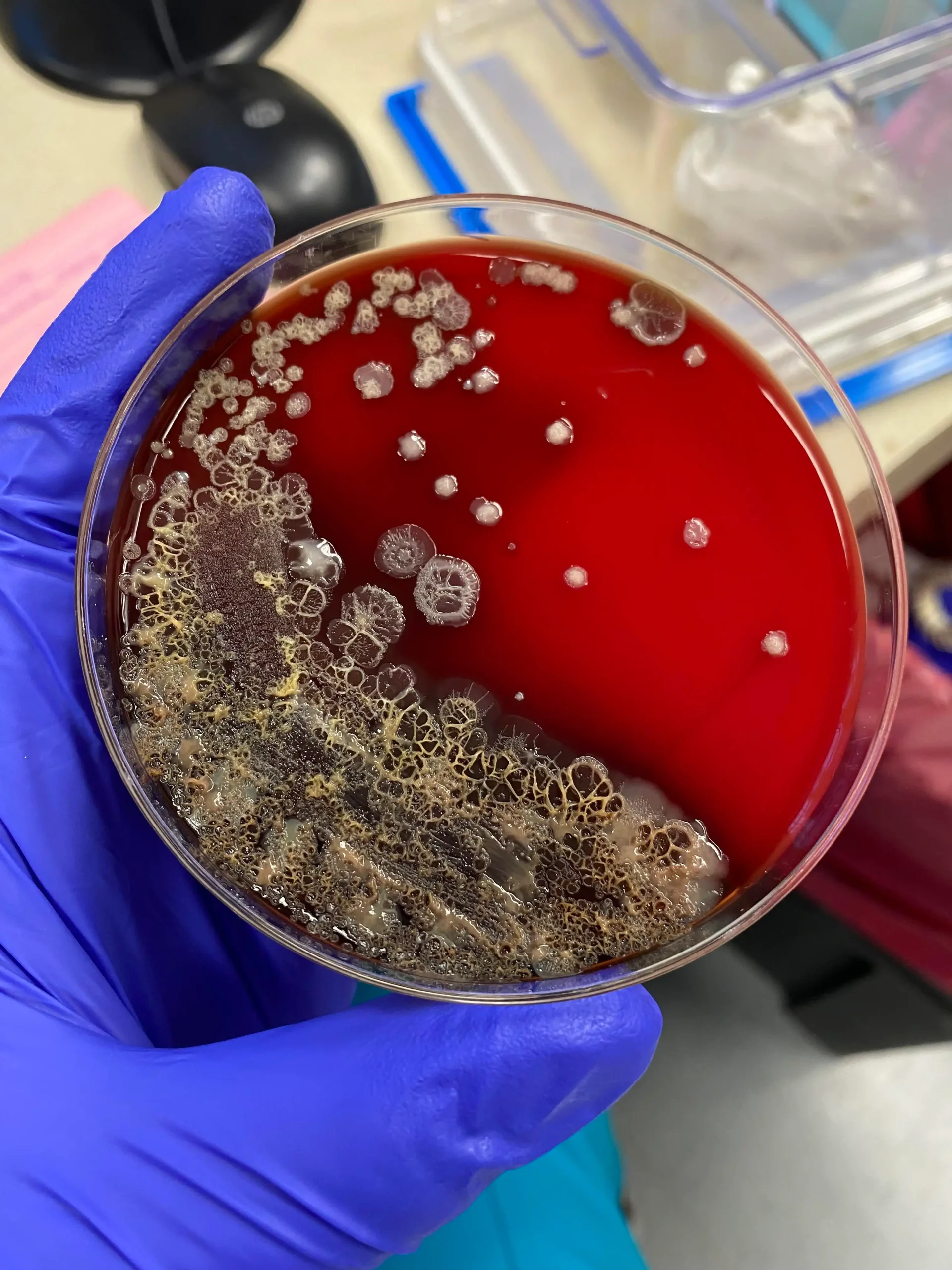 تفسیر نتایج آزمایش کشت مدفوع