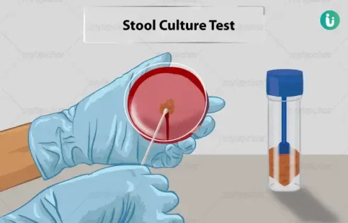 آزمایش کشت مدفوع