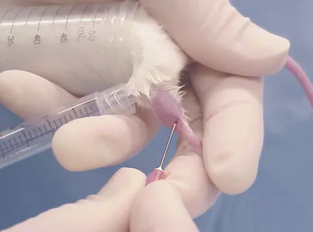 خونگیری از ورید صافن جانبی