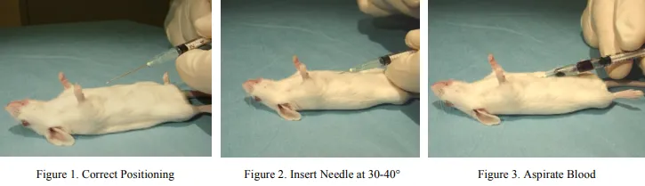 خونگیری از قلب