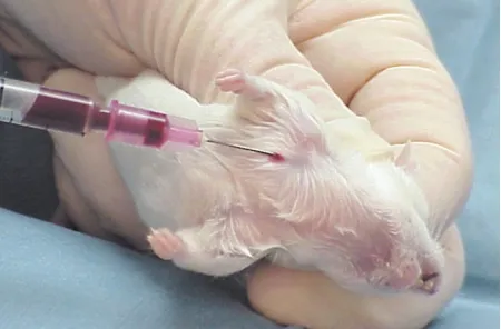 خونگیری از ورید ژوگولار