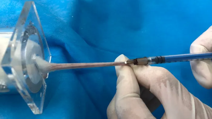 خونگیری از ورید دمی