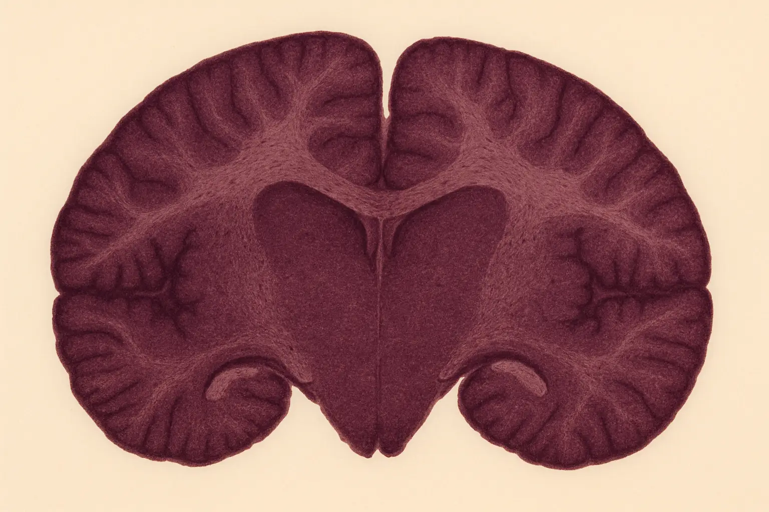 مدل بیماری افسردگی