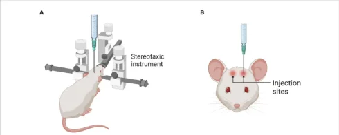 جراحی استریوتکسی