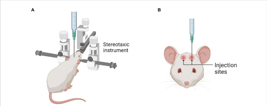 جراحی استریوتکسی